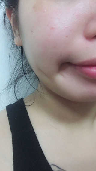 블랙모어스 내츄럴 비타민 E 크림 — 2점을 준 리뷰어가 2018년 2월 올린 사용 사진