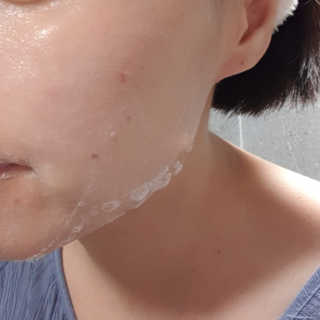페어아크네 크리미폼 페어아크네 크리미 폼 — 3.5점을 준 리뷰어가 2019년 7월 올린 사용 사진