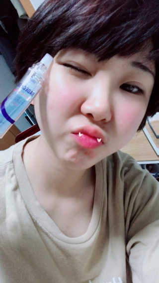 23years old 바데카실 프로 엑스퍼트 앰플 — 5점을 준 리뷰어가 2018년 6월 올린 사용 사진