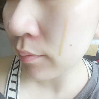 보타니티 [홍]조[진]정[결]케어 플라본 세럼 — 4점을 준 리뷰어가 2018년 5월 올린 사용 사진