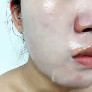 이뮤랩 immulab probiotics 내성 마스크 — 3.33점을 준 리뷰어가 2018년 9월 올린 사용 사진