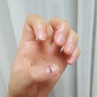 어웨이크어슬립 어슬립 페이스 리프트업 밴드 — 4점을 준 리뷰어가 2018년 7월 올린 사용 사진