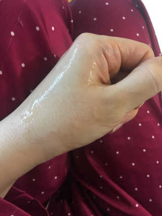메디필 셀 톡스 더마쥬 앰플 — 5점을 준 리뷰어가 2020년 2월 올린 사용 사진