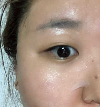 메디타임 멜라반 더마 토닝 씬젤 — 2.5점을 준 리뷰어가 2019년 6월 올린 사용 사진
