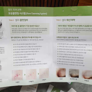 플러스셀라 시카골드 클렌징바 화산재팩 세트 — 4점을 준 리뷰어가 2019년 12월 올린 사용 사진