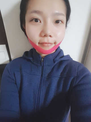 스케덤 펩타이드 리프팅밴드 — 4.5점을 준 리뷰어가 2019년 3월 올린 사용 사진