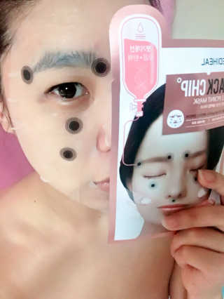 메디힐 바이오포인트 서클포인트마스크 3종 — 4.17점을 준 리뷰어가 2017년 5월 올린 사용 사진