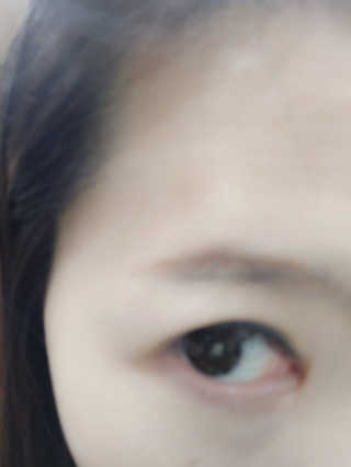 Viewty Skin and Lash [ViewtySkin＆Lash] 종아리 림프순환 부종관리 — 3점을 준 리뷰어가 2019년 4월 올린 사용 사진