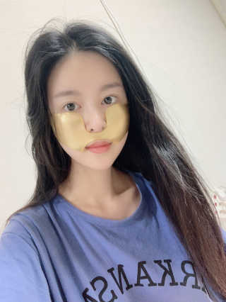 [스케덤] 상악밴드 — 5점을 준 리뷰어가 2019년 9월 올린 사용 사진