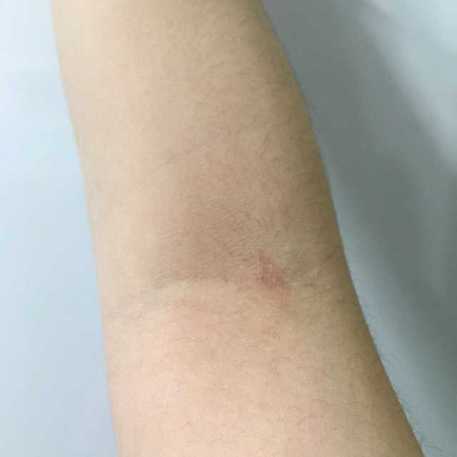 바이오오일 리뷰 사진