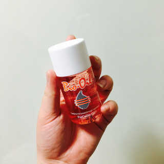 Bio-oil(바이오오일) 바이오오일 — 5점을 준 리뷰어가 2016년 10월 올린 사용 사진