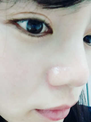 폴라초이스 리지스트 C15 슈퍼 부스터 — 3점을 준 리뷰어가 2018년 2월 올린 사용 사진
