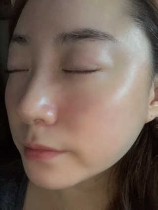 [후르디아] 주름 개선 기능성-석류 크림 미스트 — 5점을 준 리뷰어가 2019년 10월 올린 사용 사진