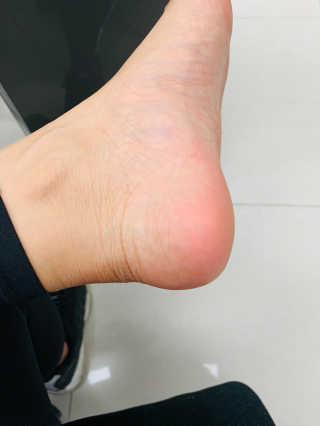 유어비 부탁해 발 부탁해 발 글라스 풋 파일 — 5점을 준 리뷰어가 2019년 4월 올린 사용 사진