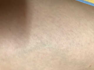 [C.razor]세라믹 제모기 택1+눈썹트리머 — 5점을 준 리뷰어가 2019년 6월 올린 사용 사진
