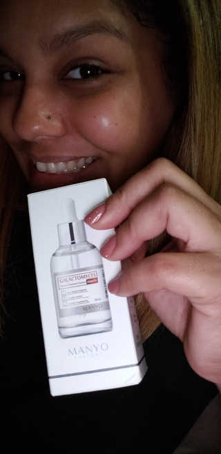 [마녀 공장] 발가락 토미 니아신 에센스 50ml — 5점을 준 리뷰어가 2018년 8월 올린 사용 사진