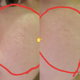 미팩토리 뿌숭뿌숭팩트 + 퍼프 2개 추가 증정 — 4점을 준 리뷰어가 2019년 3월 올린 사용 사진