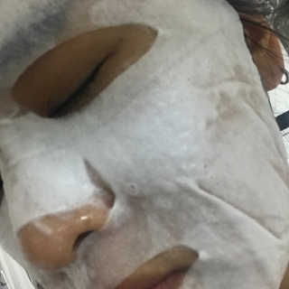오오티유 비포 앤 애프터 산소 버블 마스크 시트 — 5점을 준 리뷰어가 2018년 7월 올린 사용 사진
