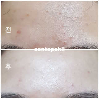 23years old 바데카실 오리지널 — 4.5점을 준 리뷰어가 2018년 3월 올린 사용 사진