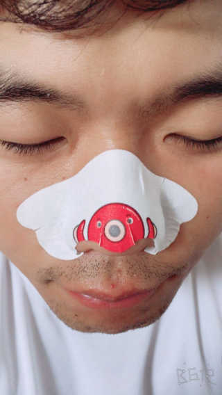 나이팅게일 TAKO PACK NOSE [문어코팩] — 5점을 준 리뷰어가 2017년 5월 올린 사용 사진