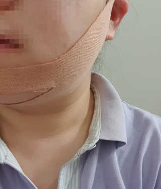 아이디플라코스메틱 아이디 페이스핏 마이너스 밴드 — 4.5점을 준 리뷰어가 2019년 12월 올린 사용 사진