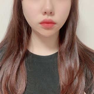 아이디플라코스메틱 아이디 페이스핏 마이너스 밴드 — 5점을 준 리뷰어가 2020년 1월 올린 사용 사진