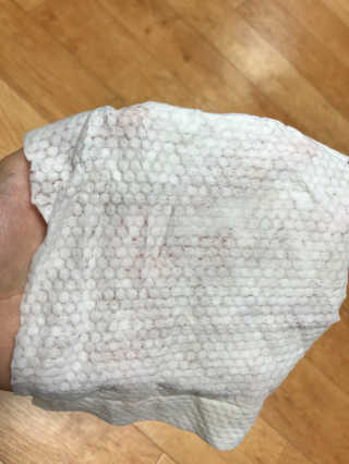 달곰이 물티슈 — 5점을 준 리뷰어가 2017년 10월 올린 사용 사진