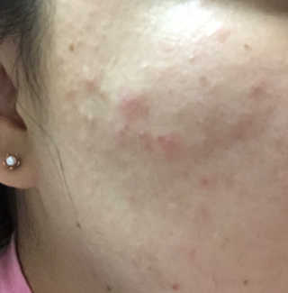 아나님이 올린 리뷰 사진 2