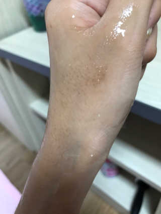 쏘내추럴 블랙티 워터팩84 — 5점을 준 리뷰어가 2019년 8월 올린 사용 사진