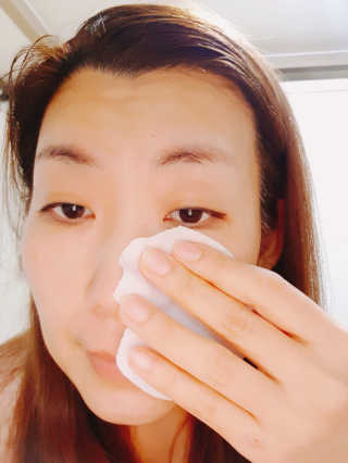 미플레이 진짜 티트리 토너 패드 — 5점을 준 리뷰어가 2018년 11월 올린 사용 사진