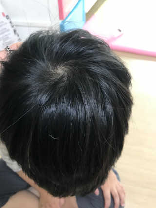 진헤나 골드 천연헤나 염색약 — 3.83점을 준 리뷰어가 2017년 9월 올린 사용 사진
