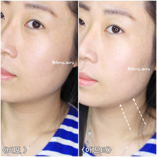 어웨이크어슬립 어슬립 페이스 리프트업 밴드 — 5점을 준 리뷰어가 2018년 6월 올린 사용 사진
