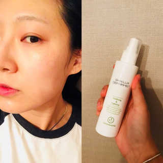 [더마허브] 스킨룩스 더마미스트 150ml — 4.67점을 준 리뷰어가 2018년 3월 올린 사용 사진