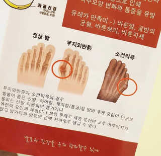 풋테크 유레카 만족이 — 3점을 준 리뷰어가 2019년 7월 올린 사용 사진