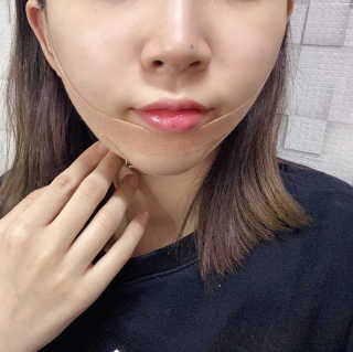 아이디플라코스메틱 아이디 페이스핏 마이너스 밴드 — 4점을 준 리뷰어가 2020년 3월 올린 사용 사진