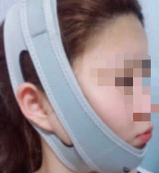 메디미 브이미 업 2스텝 브이라인벨트 — 4.5점을 준 리뷰어가 2017년 5월 올린 사용 사진