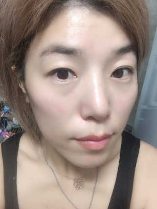 그리니프 얼티밋블레미쉬 솔루션 앰플 30ml — 5점을 준 리뷰어가 2019년 1월 올린 사용 사진