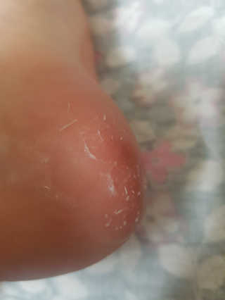아미니 릴렉싱 풋 필링 스프레이 — 4점을 준 리뷰어가 2019년 4월 올린 사용 사진