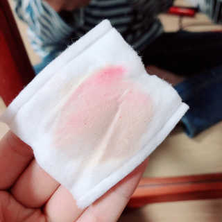 [더메디닥터] 글리셜 미셀라 클렌징 워터 — 4점을 준 리뷰어가 2019년 5월 올린 사용 사진