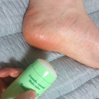 [스킨큐어] 산다화 센텔라 내추럴 멀티밤 — 5점을 준 리뷰어가 2019년 7월 올린 사용 사진