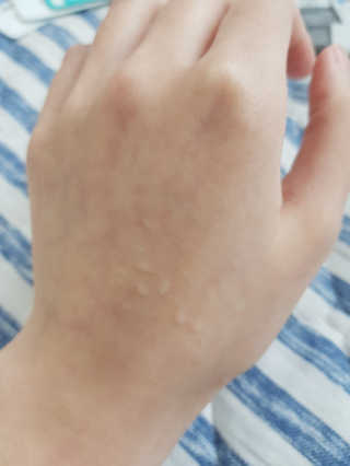 dr.eslee 안티세범 백크네 스프레이 — 4.5점을 준 리뷰어가 2019년 4월 올린 사용 사진