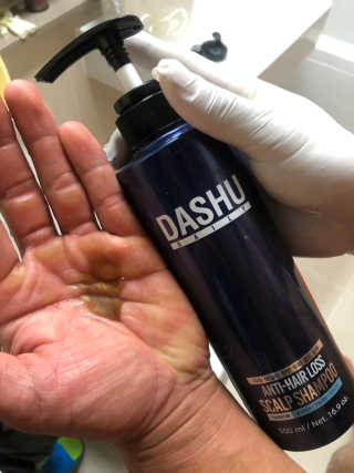 다슈코리아 다슈 단백질 한방 두피 골드 샴푸 500ml +샴푸브러쉬 — 5점을 준 리뷰어가 2019년 10월 올린 사용 사진