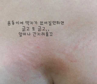 피엘메드 아토컴플렉스 엔 — 5점을 준 리뷰어가 2019년 3월 올린 사용 사진