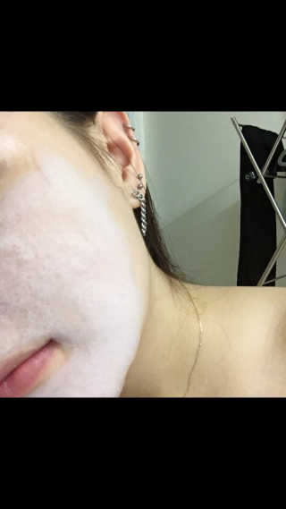 셀퓨전씨 트리악 포어 딜리트 버블 팩 — 4점을 준 리뷰어가 2018년 7월 올린 사용 사진