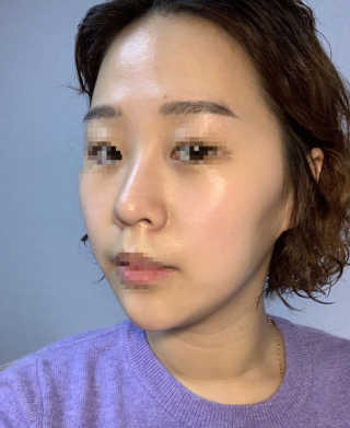 파시스 펩타이드 리프팅 크림 — 4점을 준 리뷰어가 2019년 2월 올린 사용 사진