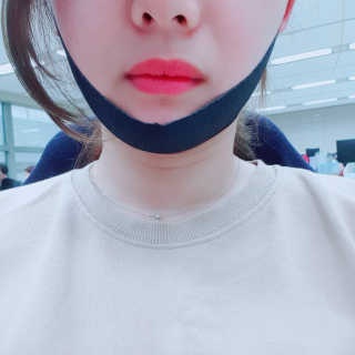 어웨이크어슬립 어슬립 페이스 리프트업 밴드 — 5점을 준 리뷰어가 2018년 5월 올린 사용 사진