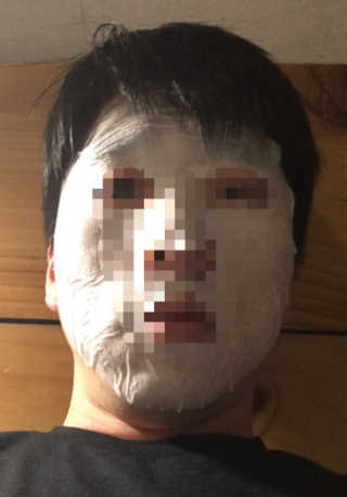 23years old 바데카실 더마실 마스크 — 5점을 준 리뷰어가 2018년 4월 올린 사용 사진
