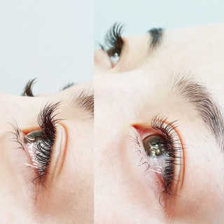 Viewty Skin and Lash [ViewtySkin＆Lash] 종아리 림프순환 부종관리 — 5점을 준 리뷰어가 2019년 2월 올린 사용 사진