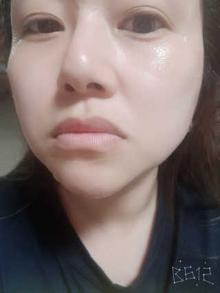 메디타임 멜라반 더마 토닝 씬젤 — 4점을 준 리뷰어가 2019년 6월 올린 사용 사진