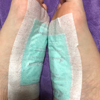 메디테라피 더마 릴렉스 힐링패치 — 5점을 준 리뷰어가 2018년 4월 올린 사용 사진